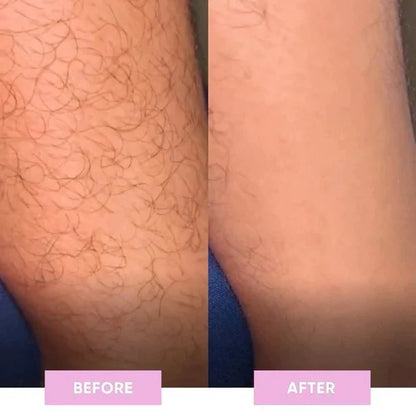 Easy Painless Hair Remover