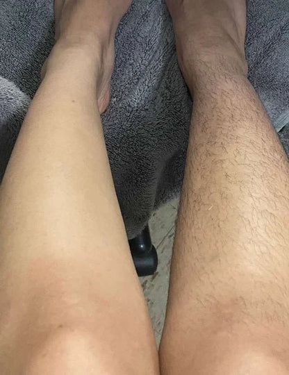 Easy Painless Hair Remover